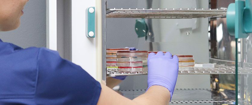 Fluorescencia Polarizada (FPA)